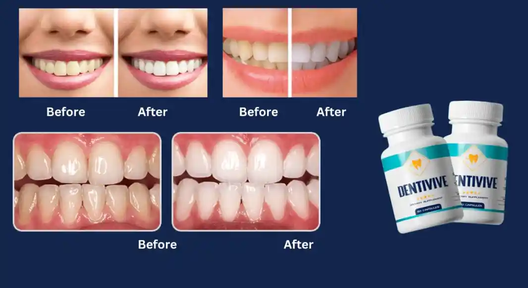DENTIVIVE