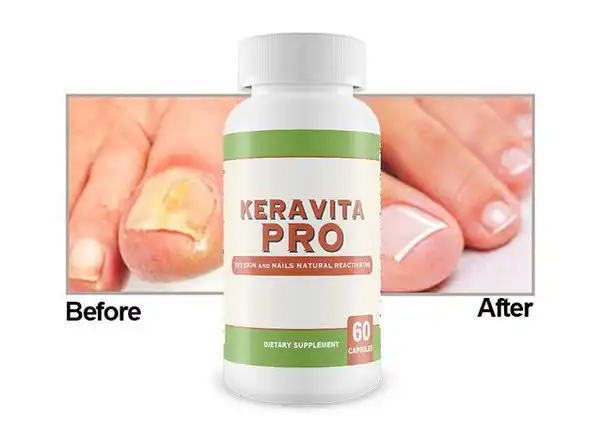 Keravita Pro official supplement frequently asked questions